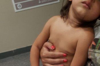 un pitbull ataco a una nena de un ano y le provoco graves heridas en una pierna