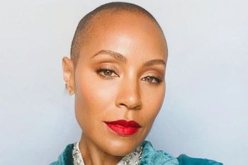 alopecia areata: la enfermedad autoinmune de la mujer de will smith