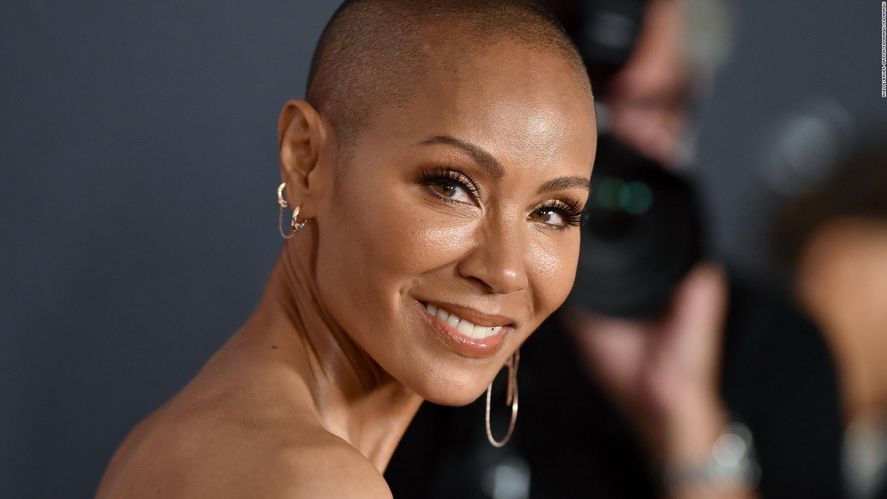 Jada Pinkett Smith es la esposa de Will Smith que sufre de alopecia. Sobre ese tema se burló Chris Rock en la entrega de los premios Oscar, y obtuvo del actor un golpe, en vivo, en medio de la ceremonia 