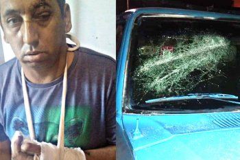 lanus: le cortaron dos dedos a un militante del frente de todos