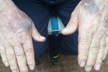 El jubilado italiano fue golpeado a piñas por 5.000 pesos