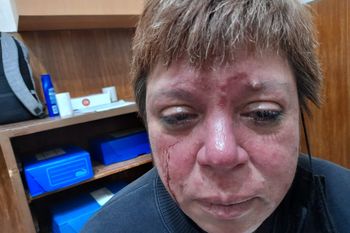 la plata: denunciaron a una hamburgueseria por ruidos molestos y una inspectora termino herida
