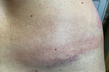 Policía de la Ciudad reprimió a la diputada Susana González: “Me dieron con las tonfas y el golpe más grande lo tengo en un riñón”
