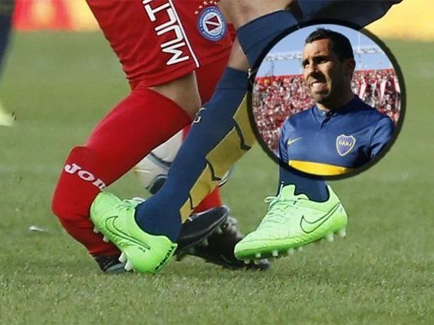 Espeluznante: la plancha de Tevez generó la fractura expuesta de tibia y peroné de Ham.
