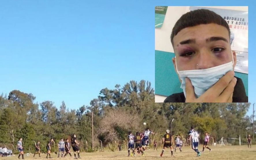 Días atrás la Liga Amateur Platense había sido escenario de otro violento hecho.
