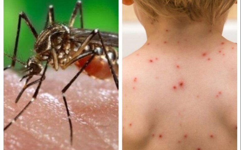 Informe: cuál es el mapa de los casos de Sarampión y Dengue en la provincia