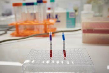 Especialistas piden testear a los asintomáticos.