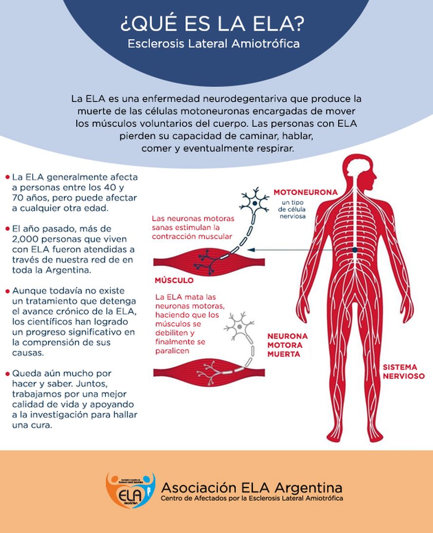 21 de junio: Día mundial de la lucha contra la enfermedad ELA