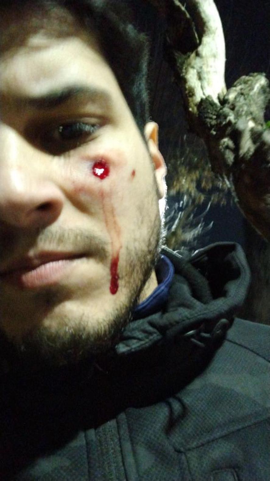 Un hincha de Independiente, herido en la cara con un balazo de goma.