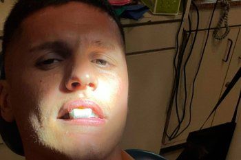 Después de jugar con Estudiantes, Guido Carrillo terminó en el dentista.