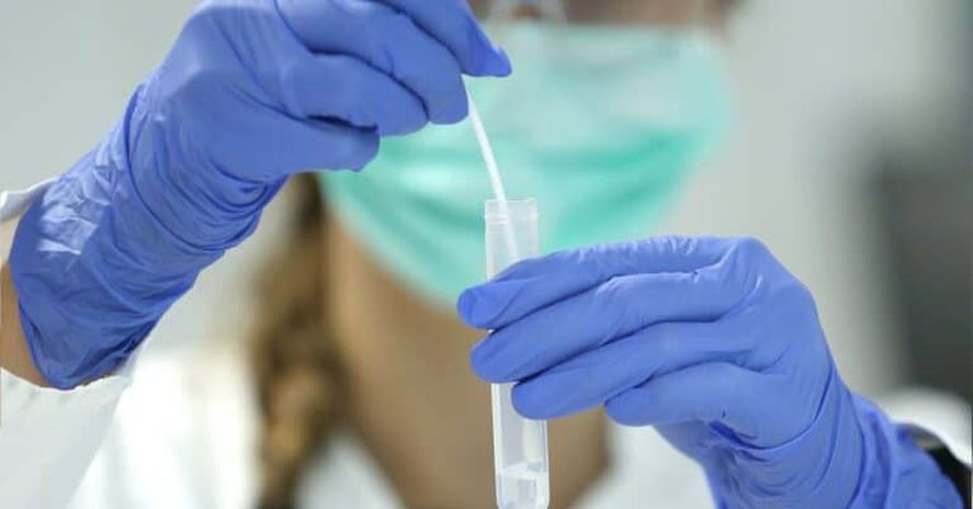 Ante la cantidad de casos del coronavirus en el país, el Ministerio de Salud Pública de la Nación explicó en qué casos se debe hacer un testeo.