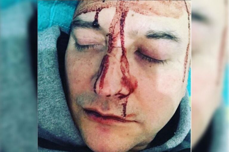Ataque homofóbico a Leo García: “Me pasó por ser gay”