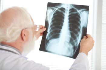 Neumonía bilateral: ¿qué es y cuáles son sus síntomas?