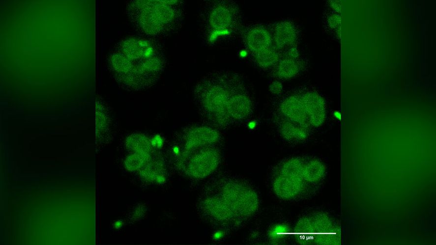Células del sistema inmune, Neutrófilos, interactuando con bacterias Escherichia coli.