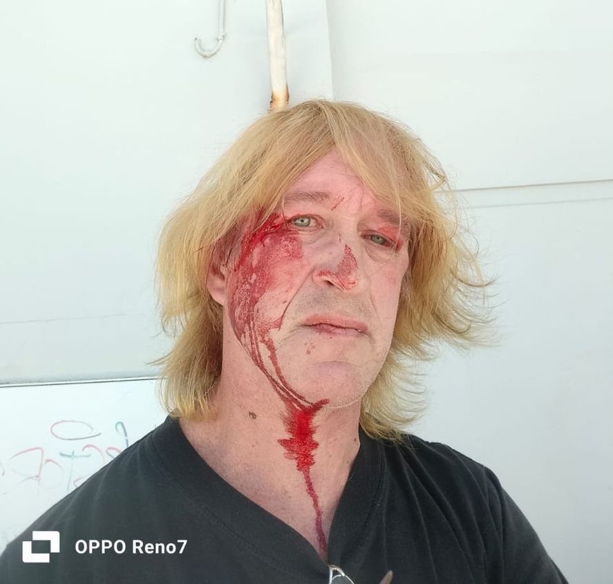 Habló el vecino agredido por el dirigente libertario de Mar Chiquita