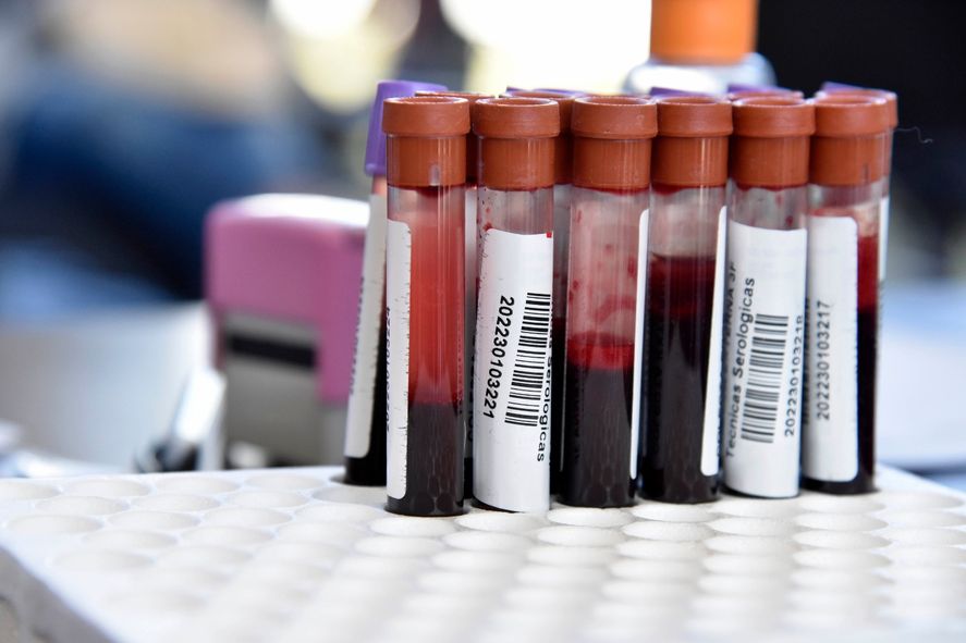 Cada 14 de junio es el Día Mundial del Donante de Sangre, un acto sencillo, rápido y muy importante. Cada 14 de junio es el Día Mundial del Donante de Sangre, un acto sencillo, rápido y muy importante.