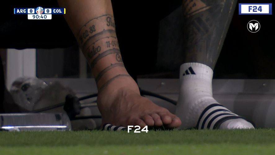 Lionel Messi y su tobillo lesionado Lionel Messi y su tobillo lesionado