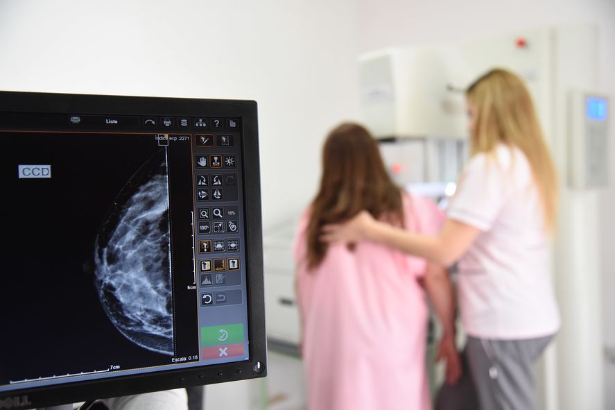 20 hospitales públicos bonaerenses realizarán mamografías gratis para prevenir el cáncer de mama.